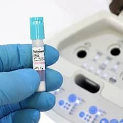 Ultra Rapid Biological Indicator for Steam Sterilization