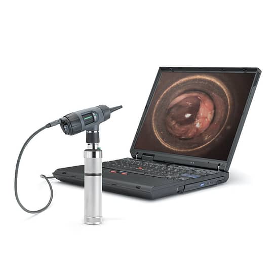 Otoscope digitale Macroview (Ordinateur et manche non inclus)