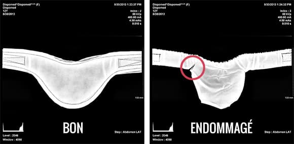 Est-ce que la protection de la thyroïde contre les rayons X est-elle  nécessaire ?