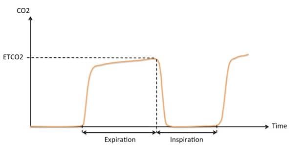 capnograph waveform