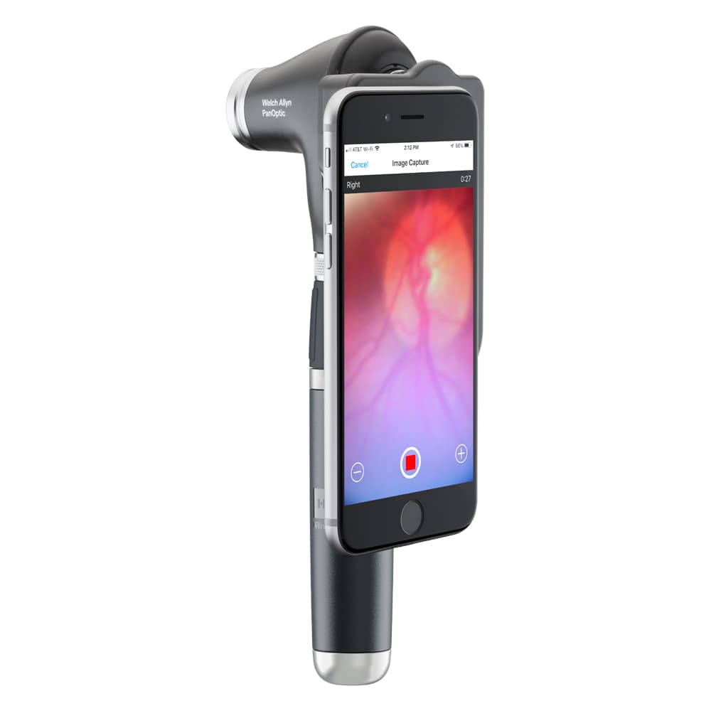 Welch Allyn PanOptic LED Ophthalmoscope with Quick Eye Alignment Technology