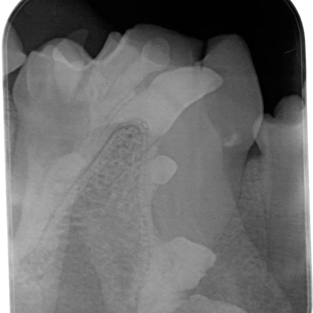 X-Ray Imaging
