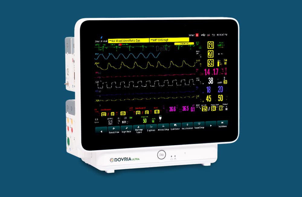 Dovria Monitors Features