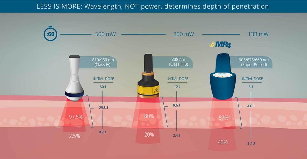 Laser Technology Schema