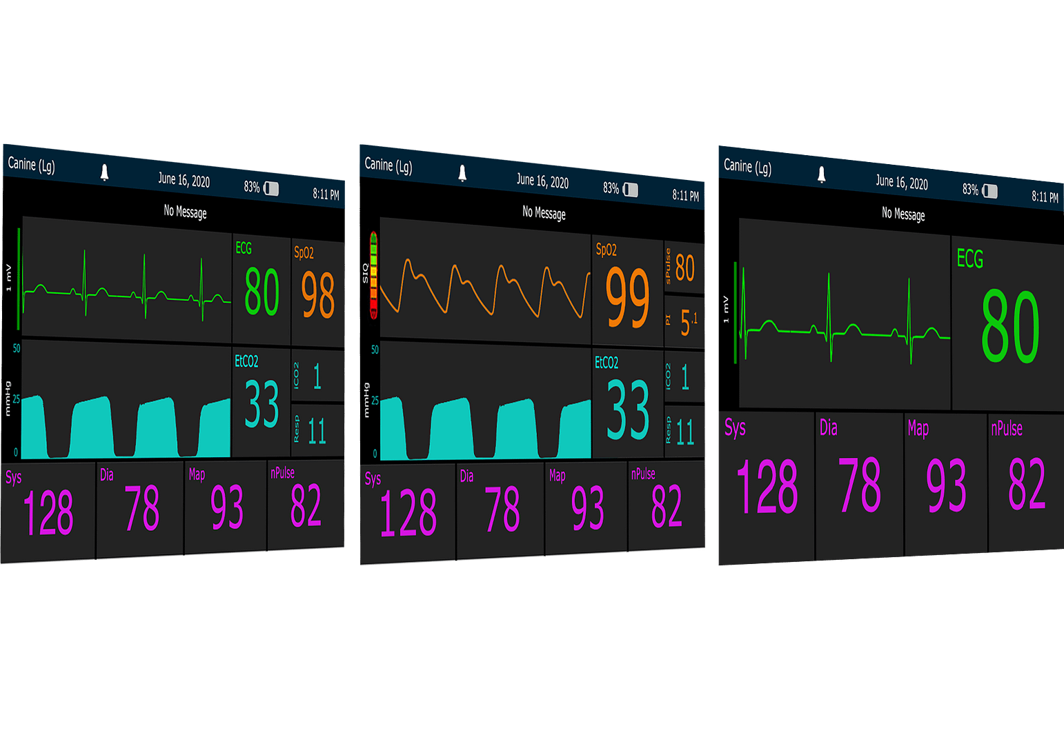 LifeWindow One monitor
