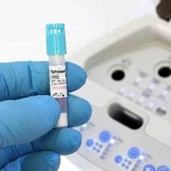 Ultra Rapid Biological Indicator for Steam Sterilization