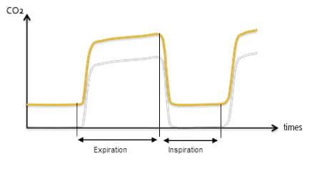 Sodalime Figure 1