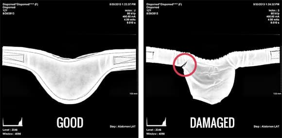 X-Ray Exemple