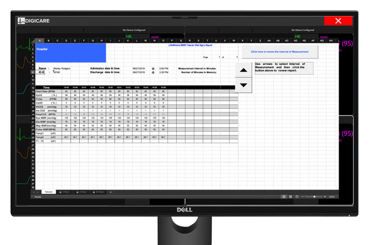Enregistrement des données