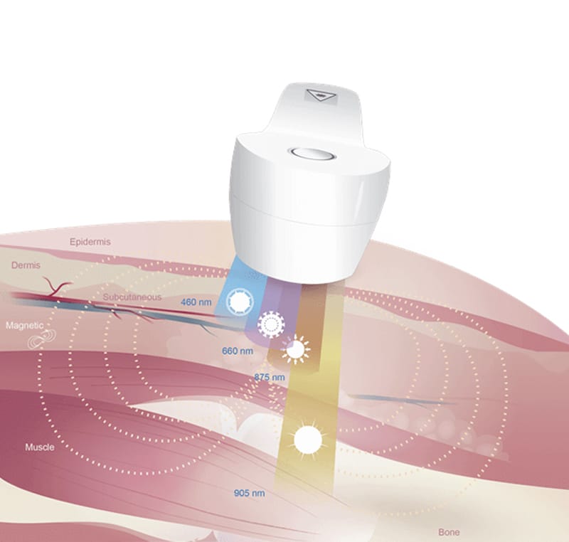 Laser Blue Light Cascade