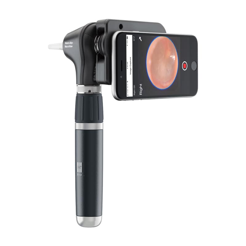 Welch Allyn MacroView Plus Otoscope