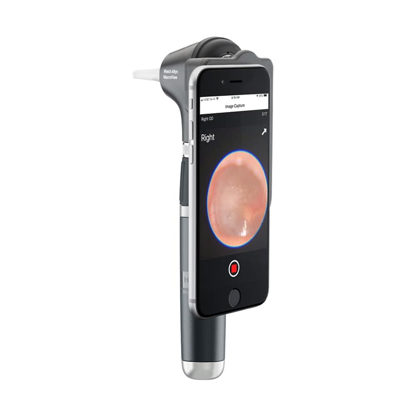 Welch Allyn MacroView Plus Otoscope