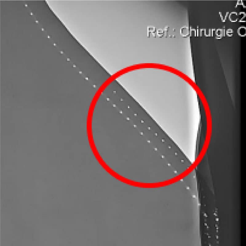 Micro-perforations dans les coutures