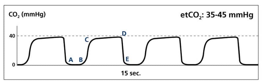 Capnograph Waves